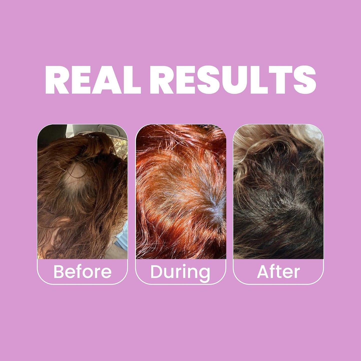 Onion Shampoo and Conditioner for Hair Growth with Biotin, Salt and Paraben Free Hair Care Duo with Keratin and Botanical Extracts for Stronger Softer Hair